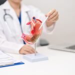 ACINO PARTE DE ARCERA PRESENTA EN PANAMÁ NUEVA OPCIÓN PARA TRATAR LA ENFERMEDAD DE REFLUJO GASTROESOFÁGICO (ERGE)