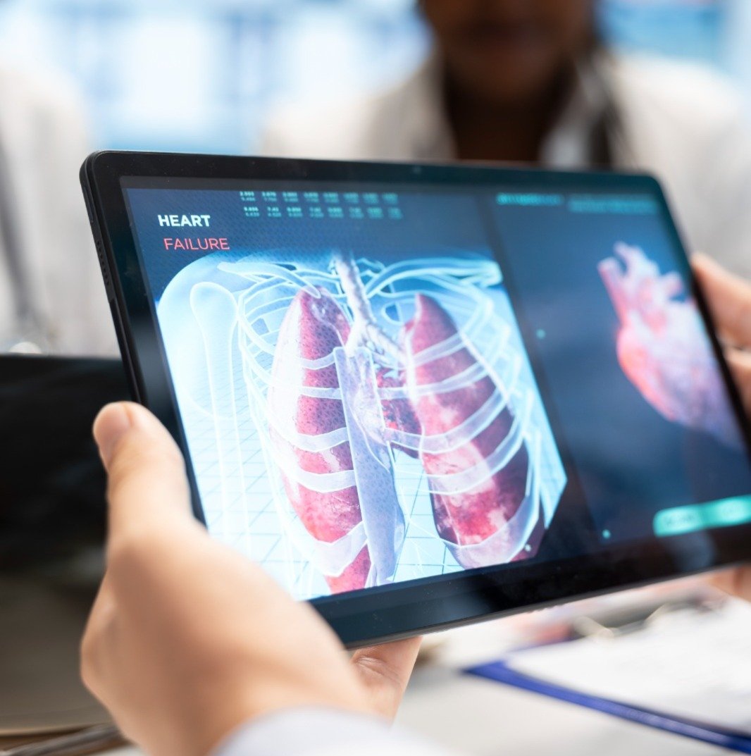El cansancio que no debería ignorarse: especialistas alertan sobre el diagnóstico tardío de la Hipertensión Arterial Pulmonar en América Latina 